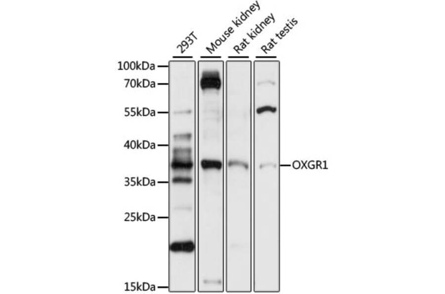 Western Blot - Anti-OXGR1/GPR99 Antibody (A89602) - Antibodies.com