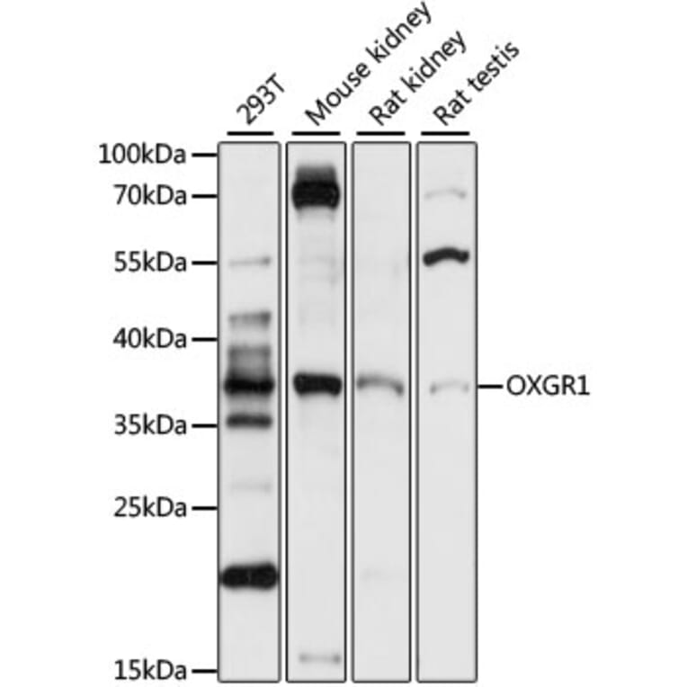 Western Blot - Anti-OXGR1/GPR99 Antibody (A89602) - Antibodies.com