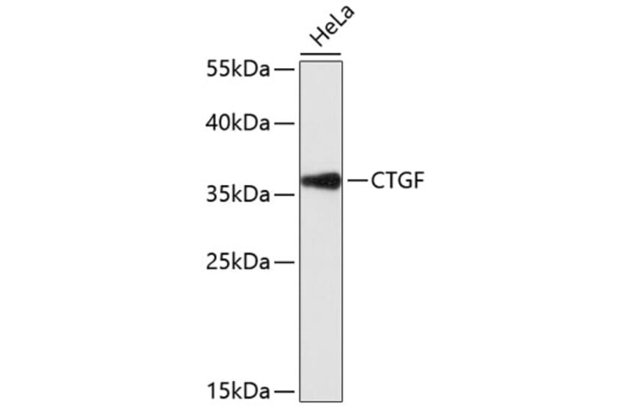 Western Blot - Anti-CTGF Antibody (A11943) - Antibodies.com