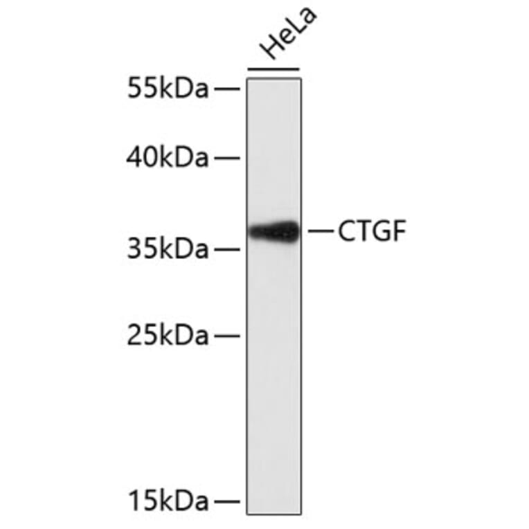 Western Blot - Anti-CTGF Antibody (A11943) - Antibodies.com
