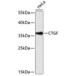 Western Blot - Anti-CTGF Antibody (A11943) - Antibodies.com