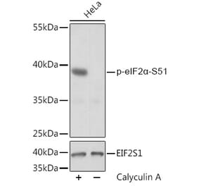 Western Blot - Anti-EIF2S1 (phospho Ser51) Antibody (A89604) - Antibodies.com