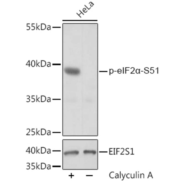 Western Blot - Anti-EIF2S1 (phospho Ser51) Antibody (A89604) - Antibodies.com