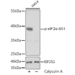 Western Blot - Anti-EIF2S1 (phospho Ser51) Antibody (A89604) - Antibodies.com