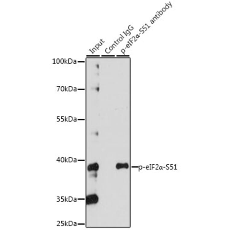 Western Blot - Anti-EIF2S1 (phospho Ser51) Antibody (A89604) - Antibodies.com
