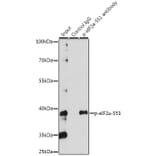 Western Blot - Anti-EIF2S1 (phospho Ser51) Antibody (A89604) - Antibodies.com