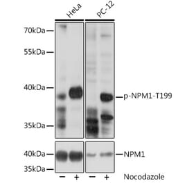 Western Blot - Anti-Nucleophosmin (phospho Thr199) Antibody (A89605) - Antibodies.com