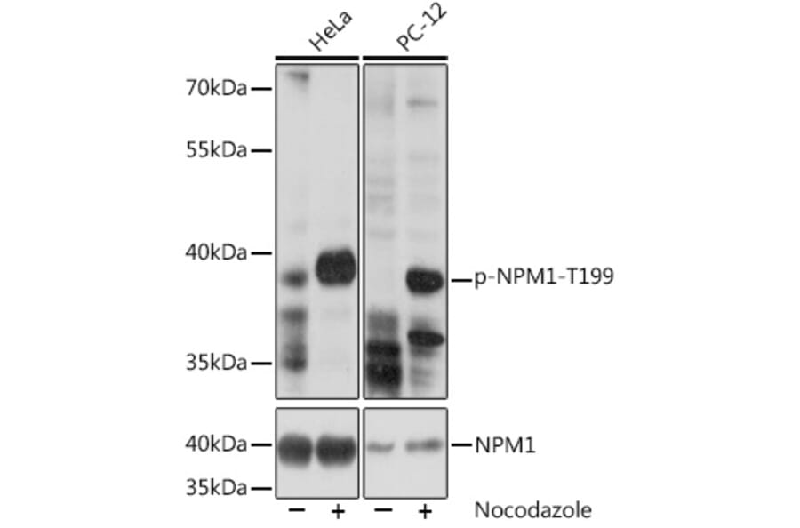 Western Blot - Anti-Nucleophosmin (phospho Thr199) Antibody (A89605) - Antibodies.com