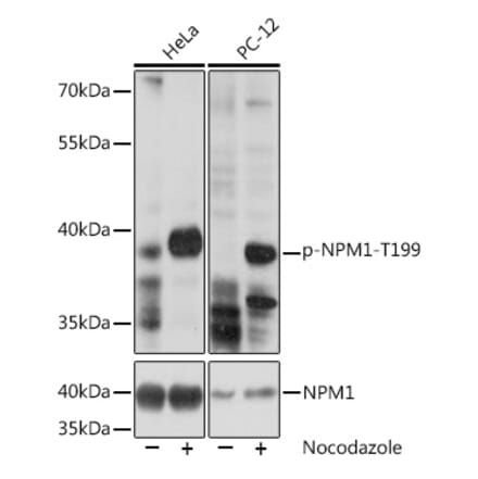 Western Blot - Anti-Nucleophosmin (phospho Thr199) Antibody (A89605) - Antibodies.com