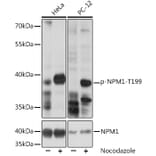 Western Blot - Anti-Nucleophosmin (phospho Thr199) Antibody (A89605) - Antibodies.com