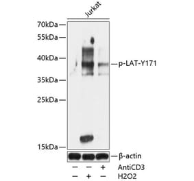 Western Blot - Anti-LAT (phospho Tyr171) Antibody (A89606) - Antibodies.com