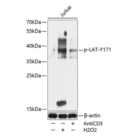Western Blot - Anti-LAT (phospho Tyr171) Antibody (A89606) - Antibodies.com