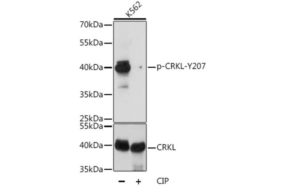 Western Blot - Anti-CrkL (phospho Tyr207) Antibody (A89607) - Antibodies.com
