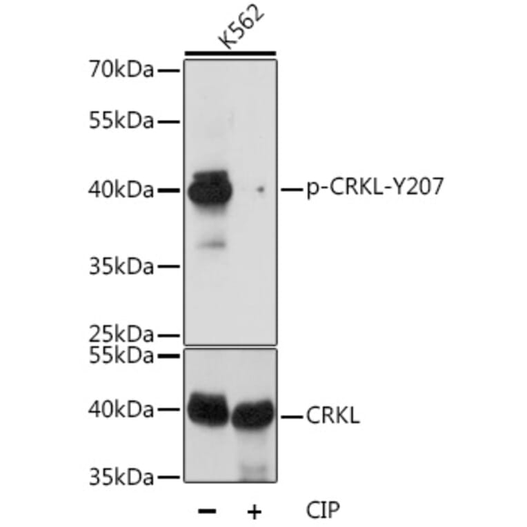 Western Blot - Anti-CrkL (phospho Tyr207) Antibody (A89607) - Antibodies.com