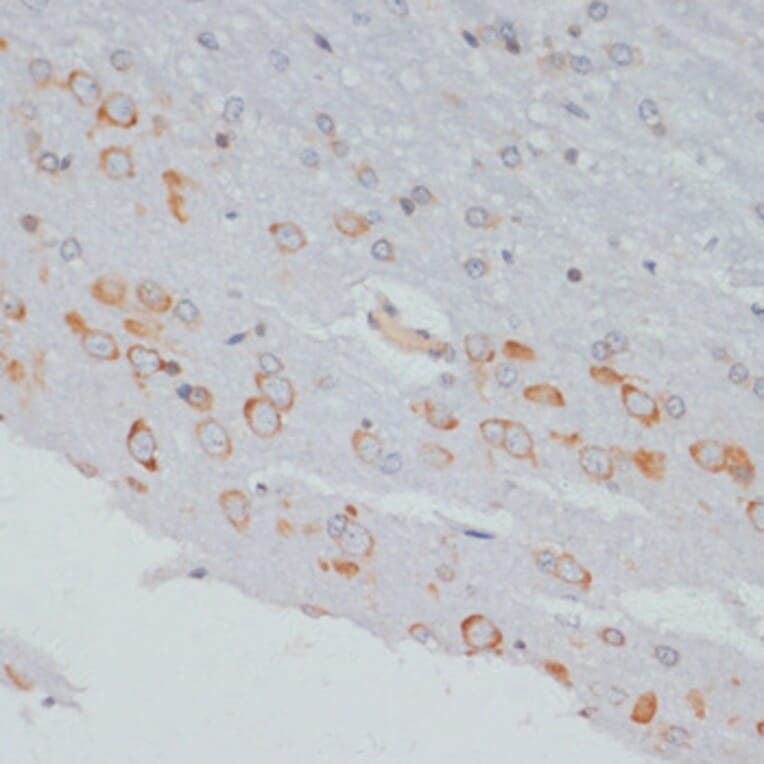 Immunohistochemistry - Anti-CrkL (phospho Tyr207) Antibody (A89607) - Antibodies.com