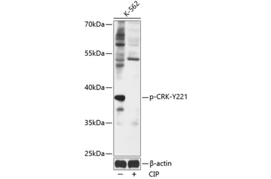 Western Blot - Anti-Crk p38 (phospho Tyr221) Antibody (A89608) - Antibodies.com