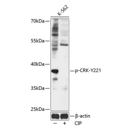 Western Blot - Anti-Crk p38 (phospho Tyr221) Antibody (A89608) - Antibodies.com