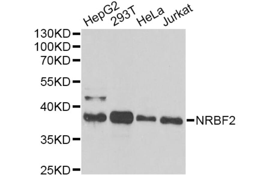 Western Blot - Anti-NRBF2 Antibody (A13422) - Antibodies.com
