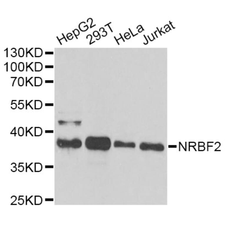 Western Blot - Anti-NRBF2 Antibody (A13422) - Antibodies.com