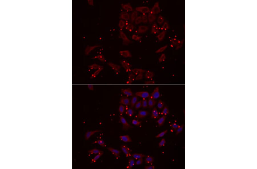 Immunofluorescence - Anti-NRBF2 Antibody (A13422) - Antibodies.com
