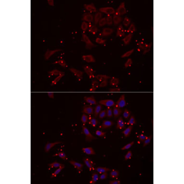 Immunofluorescence - Anti-NRBF2 Antibody (A13422) - Antibodies.com