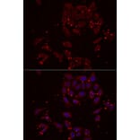 Immunofluorescence - Anti-NRBF2 Antibody (A13422) - Antibodies.com