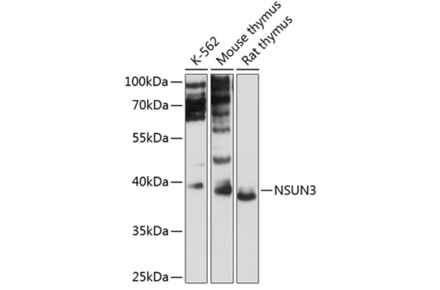 Western Blot - Anti-NSUN3 Antibody (A89611) - Antibodies.com