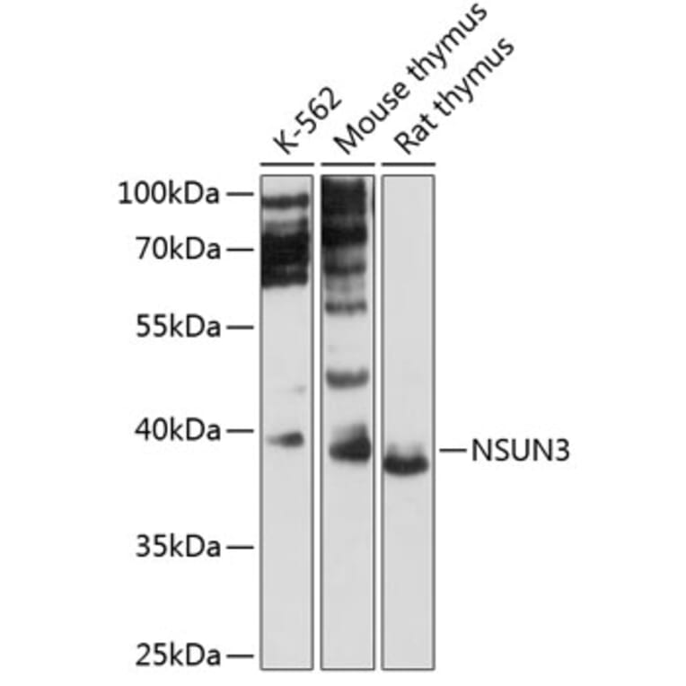 Western Blot - Anti-NSUN3 Antibody (A89611) - Antibodies.com