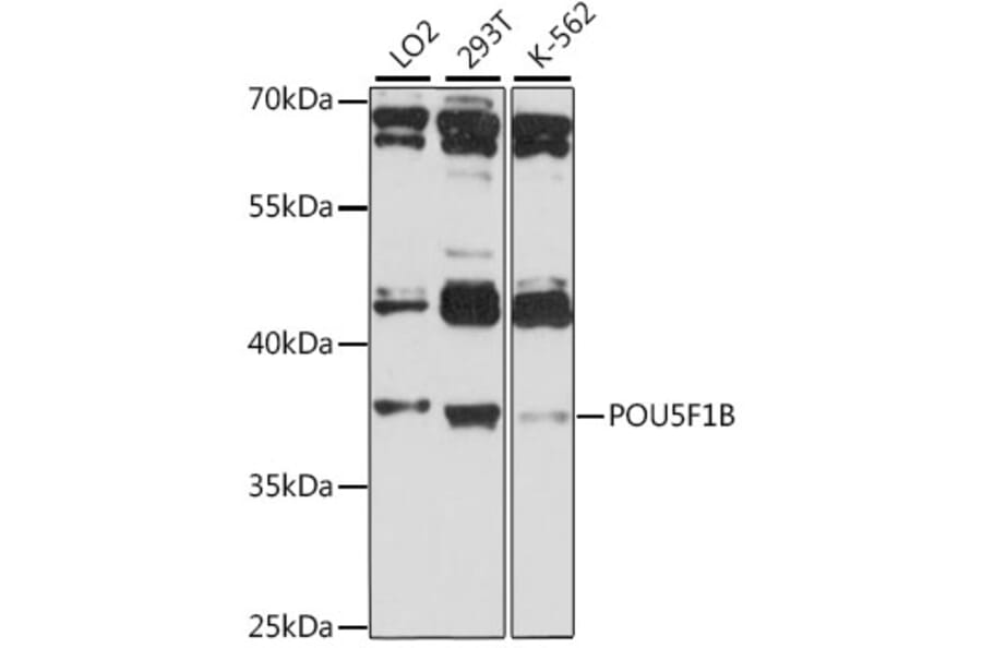 Western Blot - Anti-POU5F1B Antibody (A89612) - Antibodies.com