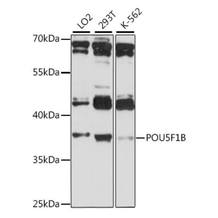 Western Blot - Anti-POU5F1B Antibody (A89612) - Antibodies.com