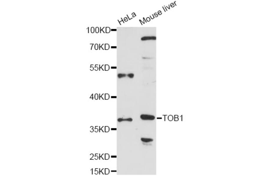 Western Blot - Anti-TOB1 Antibody (A14835) - Antibodies.com