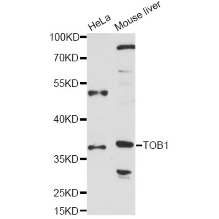 Western Blot - Anti-TOB1 Antibody (A14835) - Antibodies.com