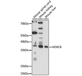 Western Blot - Anti-HOXC8 Antibody (A89614) - Antibodies.com