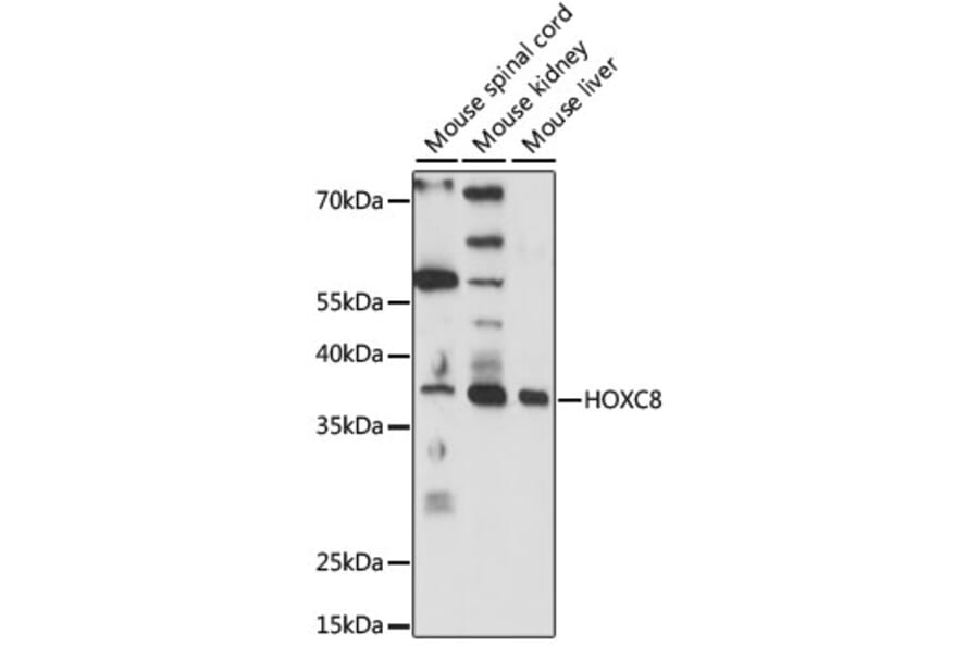 Western Blot - Anti-HOXC8 Antibody (A89614) - Antibodies.com