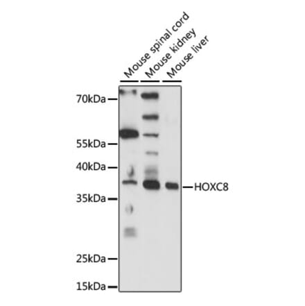 Western Blot - Anti-HOXC8 Antibody (A89614) - Antibodies.com