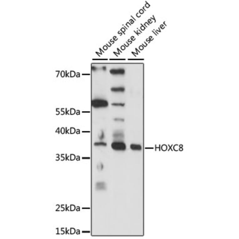 Western Blot - Anti-HOXC8 Antibody (A89614) - Antibodies.com