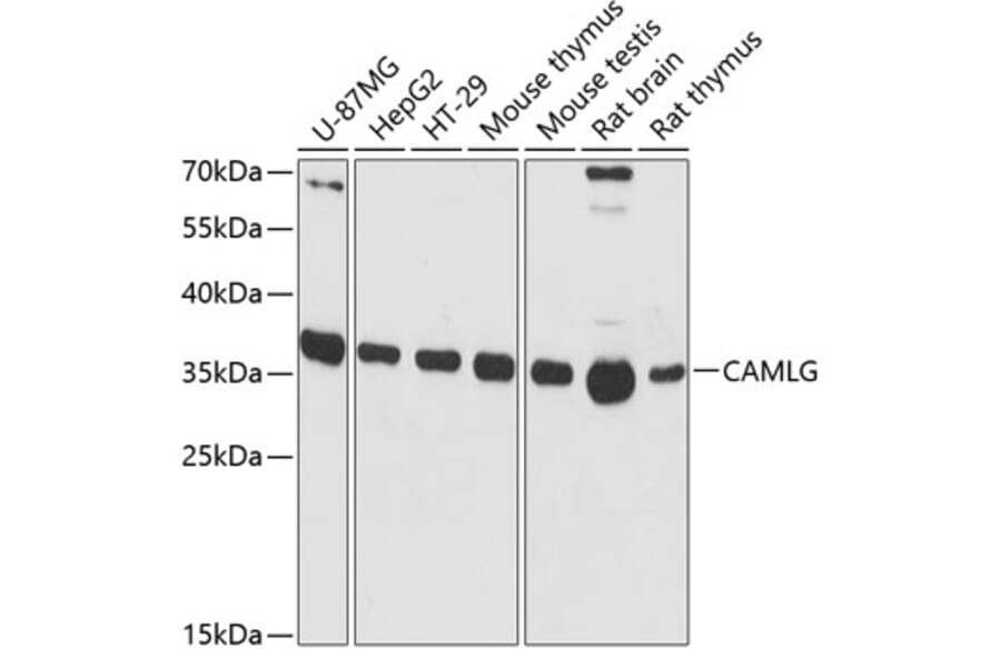 Western Blot - Anti-CAMLG/CAML Antibody (A89615) - Antibodies.com