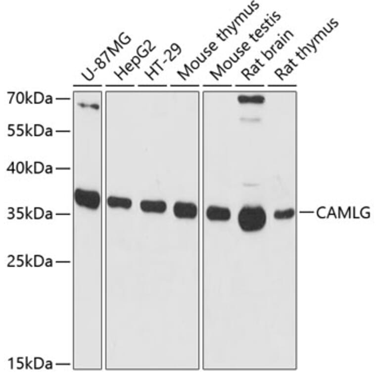Western Blot - Anti-CAMLG/CAML Antibody (A89615) - Antibodies.com