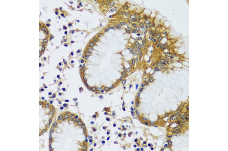 Immunohistochemistry - Anti-CAMLG/CAML Antibody (A89615) - Antibodies.com