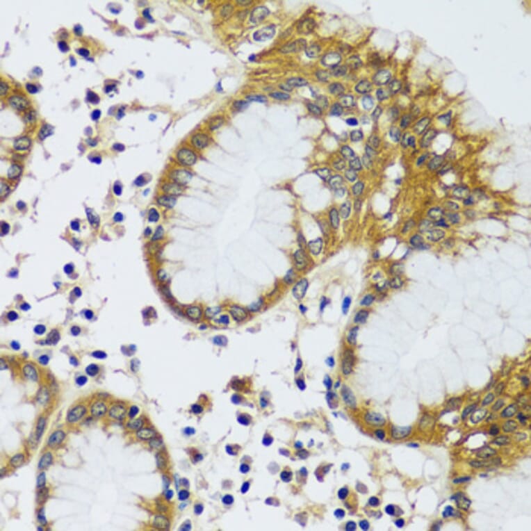 Immunohistochemistry - Anti-CAMLG/CAML Antibody (A89615) - Antibodies.com