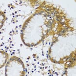 Immunohistochemistry - Anti-CAMLG/CAML Antibody (A89615) - Antibodies.com