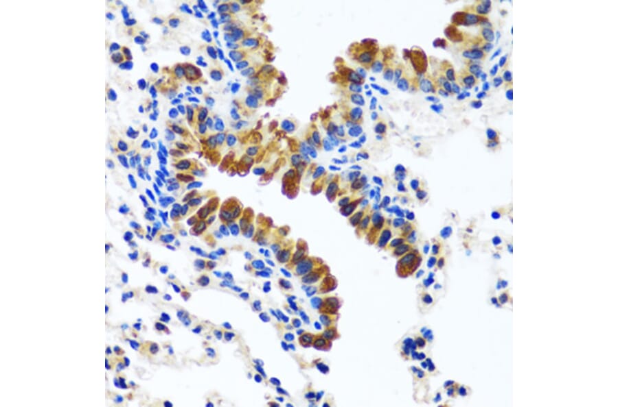 Immunohistochemistry - Anti-CAMLG/CAML Antibody (A89615) - Antibodies.com