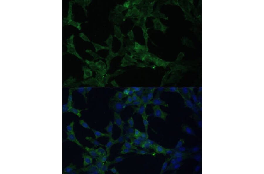 Immunofluorescence - Anti-CAMLG/CAML Antibody (A89615) - Antibodies.com