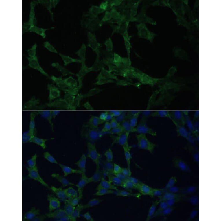 Immunofluorescence - Anti-CAMLG/CAML Antibody (A89615) - Antibodies.com