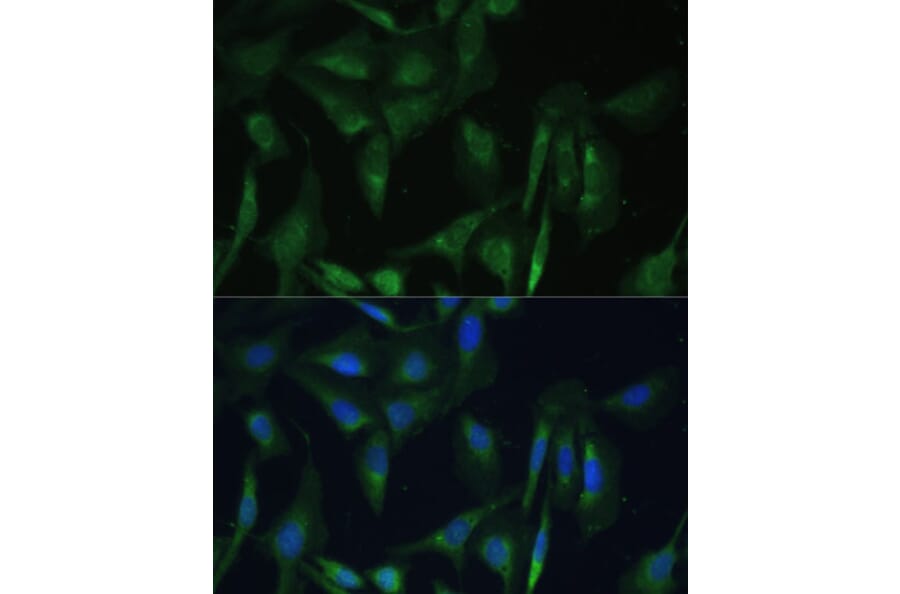 Immunofluorescence - Anti-CAMLG/CAML Antibody (A89615) - Antibodies.com