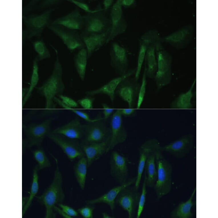 Immunofluorescence - Anti-CAMLG/CAML Antibody (A89615) - Antibodies.com