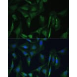 Immunofluorescence - Anti-CAMLG/CAML Antibody (A89615) - Antibodies.com