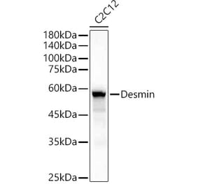 Western Blot - Anti-Desmin Antibody (A89616) - Antibodies.com