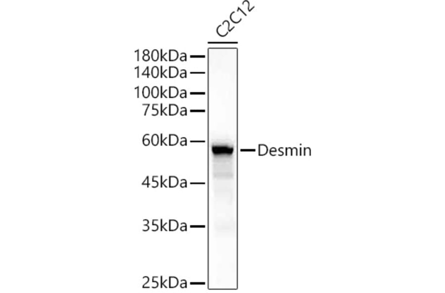 Western Blot - Anti-Desmin Antibody (A89616) - Antibodies.com