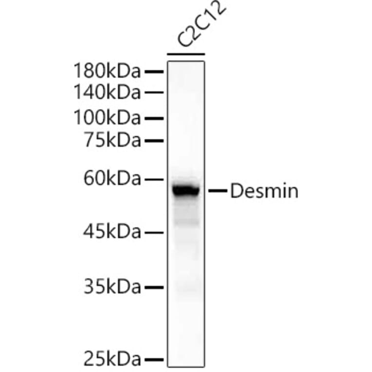 Western Blot - Anti-Desmin Antibody (A89616) - Antibodies.com